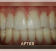 How to Pick a Family Dental Practitioner That Is Best for You